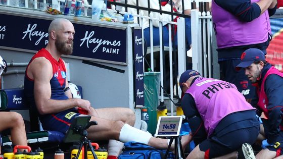 Max Gawn injury update, Melbourne Demons, Melbourne Demons ruck dilemma, injury latest, latest news – MASHAHER