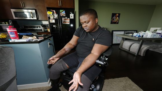 Police recruit who lost both legs in ‘barbaric hazing ritual’ sues Denver, paramedics and officers – MASHAHER