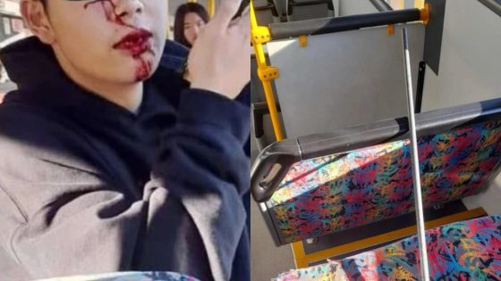 16-year-old Chinese boy beat with iron rod on New Zealand bus – MASHAHER