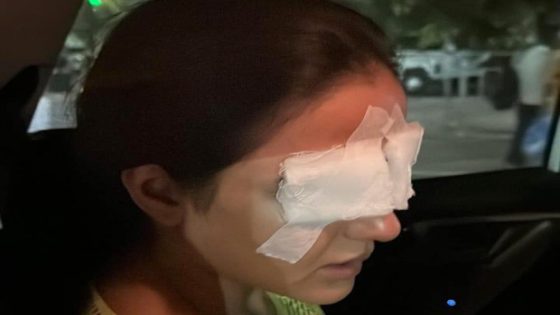 Jasmine Bhasin battles corneal damage after lens mishap, leaves her in pain : Bollywood News – MASHAHER