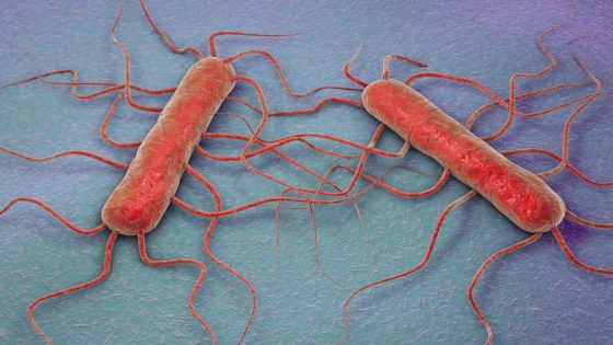 Listeria symptoms, prevention tips & more to know – MASHAHER