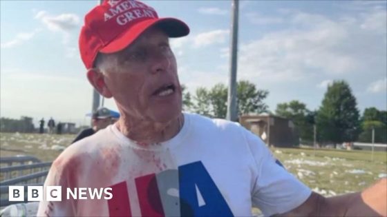 ‘I did CPR’ – doctor says he helped man shot at Trump rally – MASHAHER