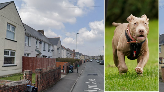 XL Bully attack left 10-year-old in hospital after ‘angry and vicious’ attack – MASHAHER