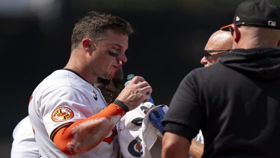 Orioles’ James McCann stays in game after taking fastball to his face – MASHAHER