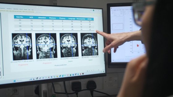 New AI tool could be game-changer in battle against Alzheimer’s | Science & Tech News – MASHAHER