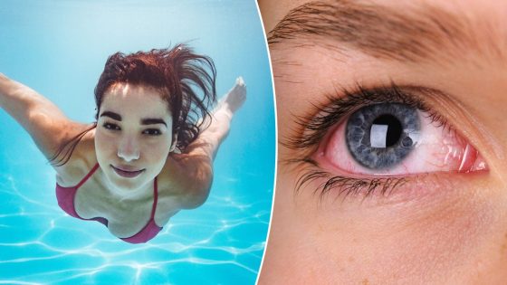 Ask a doctor: ‘Is it safe to swim underwater with my eyes open?’ – MASHAHER