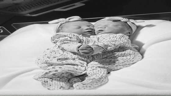 Atlanta couple’s conjoined twin daughters, fused at the heart, lived for just 1 hour: ‘Gift from God’ – MASHAHER