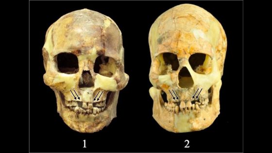 Ancient people in Taiwan yanked healthy teeth from their mouths for ‘aesthetic expression’ and ‘tests of courage,’ study finds – MASHAHER