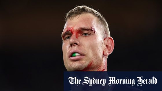 Bloodied Manly Sea Eagles star Tom Trbojevic leaves field early with shoulder injury – MASHAHER