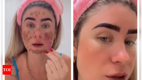 No science behind: Brazilian influencer’s poop face mask draws flak from doctors – MASHAHER