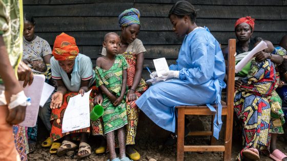 Battling Mpox in the Outbreak’s Epicenter in Congo – MASHAHER