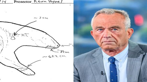 RFK Jr. stuck his hand in the Central Park bear’s mouth. Necropsy shows he may have been knuckle-deep in her leaked brain. – MASHAHER