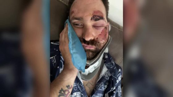 Milwaukee Army reservist violently attacked; family seeks answers – MASHAHER