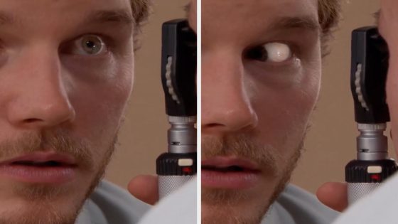 This Eye Doctor Is Revealing The Absolute Worst Thing You Can Do For Your Eyes, And It’s Really Bad – MASHAHER