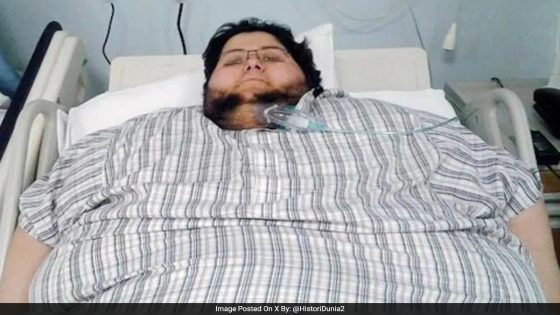 Saudi Man’s Incredible 500-kg Weight Loss: See Before-After Pics – MASHAHER