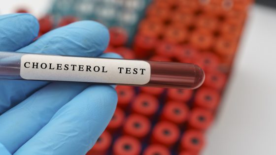 These Are the Exact Cholesterol Numbers You Should Aim for If You Want to Prevent Heart Disease, According to a Cardiologist – MASHAHER