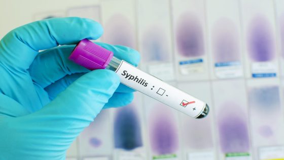 Syphilis cases are on the rise. The FDA just approved a home test that could combat that. – MASHAHER