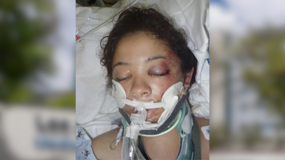 L.A. hospital seeks help identifying injured woman found lying on ground – MASHAHER