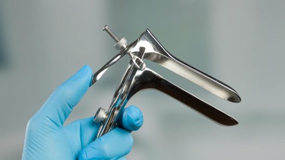 Alternatives to the traditional pap smear are on the way. Here’s what to know. – MASHAHER