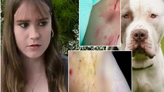 Teenager feared she would die after being mauled by 50kg XL Bully – MASHAHER