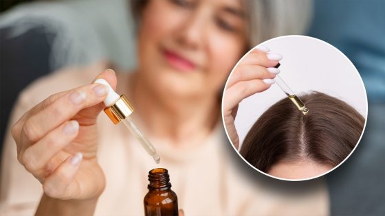 Types of oils that can be used to promote hair growth, according to an expert – MASHAHER