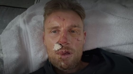 Freddie Flintoff reveals extent of injuries after Top Gear crash | Ents & Arts News – MASHAHER