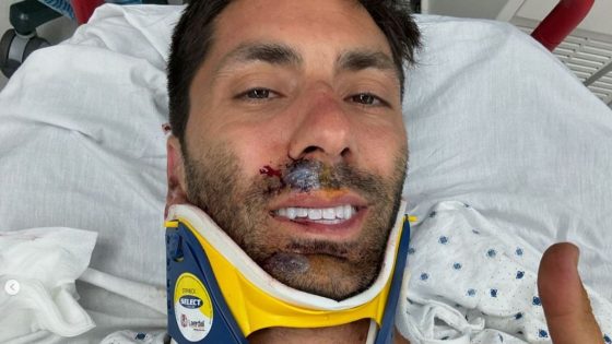 Catfish presenter Nev Schulman breaks neck in bike crash | US News – MASHAHER