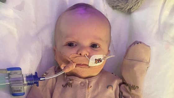 Parents of 11-week-old baby who needs an urgent heart transplant urge people to become donors | UK News – MASHAHER