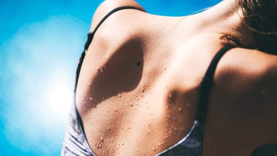 The ‘hidden’ Australian skin cancer problem that has researchers concerned – MASHAHER