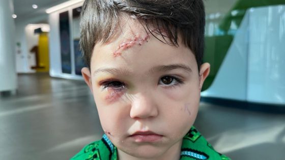 Swayde Rangi: Mother of four-year-old boy calls for dog to be put down after horror mauling – MASHAHER