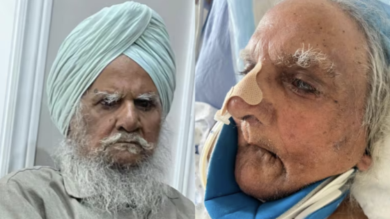 Sikh man was shaved without consent at Brampton hospital: complaint – MASHAHER