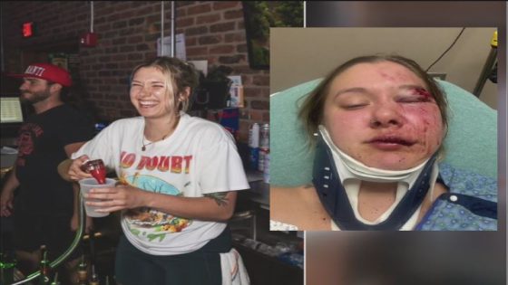 Mount Clemens woman brutally beaten randomly in Detroit – MASHAHER