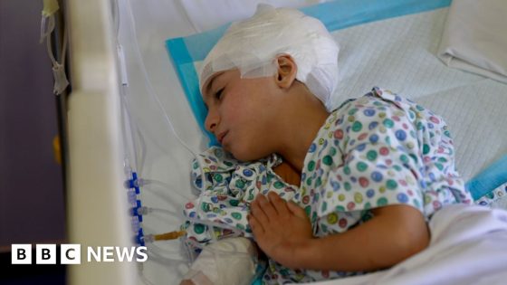 Young Lebanese girl left fighting for life after Israeli strikes – MASHAHER