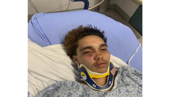 A transgender teen in Massachusetts says other high schoolers beat him at a party – MASHAHER