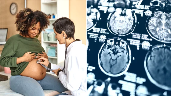 How pregnancy changes a woman’s brain, according to a new study – MASHAHER