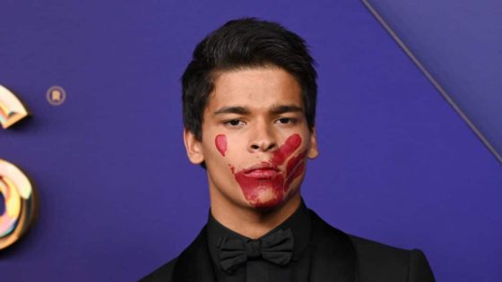 This First Nations actor had a red hand painted on his face at the Emmys. Here’s what it means – MASHAHER