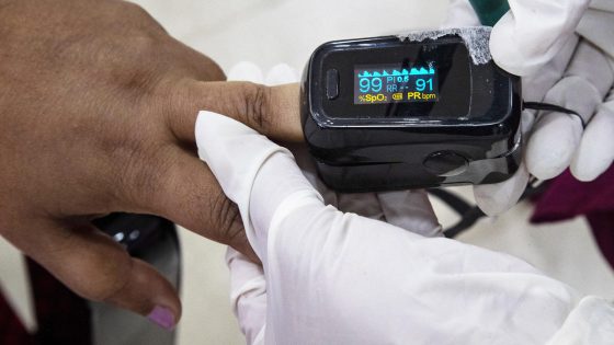 FDA’s promised rules on pulse oximeters unlikely to end decades of racial bias – MASHAHER