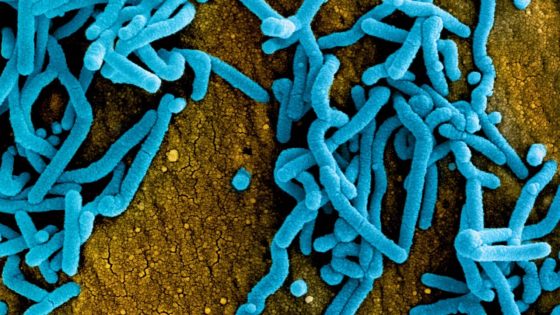 Marburg virus kills around half of those infected. What is it and how does it spread? – MASHAHER